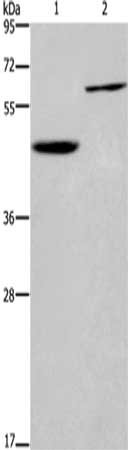 Gel: 8%SDS-PAGE,Lysate: 40 ug,Lane 1-2: Human hepatocellsular carcinoma tissue, Jurkat cells,Primary antibody: CSB-PA040823(DOK1 Antibody) at dilution 1/450 dilution,Secondary antibody: Goat anti rabbit IgG at 1/8000 dilution,Exposure time: 20 seconds