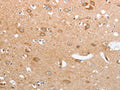 The image on the left is immunohistochemistry of paraffin-embedded Human brain tissue using CSB-PA041334(CASP12 Antibody) at dilution 1/50, on the right is treated with synthetic peptide. (Original magnification: ×200)