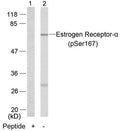 Western blot analysis of extracts from MCF7 cells using Estrogen Receptor-a(Phospho-Ser167) Antibody(Lane 2) and the same antibody preincubated with blocking peptide(Lane1).