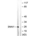 Western blot analysis of extracts from HT29 cells, using SNAI1 (Ab-246) antibody.