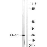 Western blot analysis of extracts from HT29 cells, using SNAI1 (Ab-246) antibody.