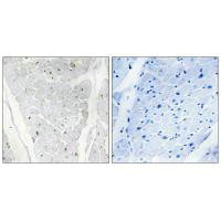 Immunohistochemistry analysis of paraffin-embedded human heart tissue, using ALPK2 antibody.