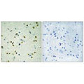 Immunohistochemistry analysis of paraffin-embedded human brain tissue, using JHD3B antibody.