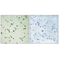 Immunohistochemistry analysis of paraffin-embedded human brain tissue, using JHD3B antibody.