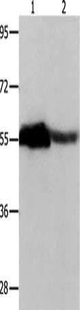 Gel: 10+12%SDS-PAGE, Lysate: 30 ug, Lane 1-2: Human ovarian cancer tissue, mouse heart tissue, Primary antibody: CSB-PA042961(CBX2 Antibody) at dilution 1/350, Secondary antibody: Goat anti rabbit IgG at 1/8000 dilution, Exposure time: 20 seconds