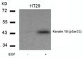 Western blot analysis of extracts from HT29 cells untreated or treated with EGF using Keratin 18(Phospho-Ser33) Antibody.