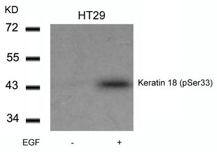 Western blot analysis of extracts from HT29 cells untreated or treated with EGF using Keratin 18(Phospho-Ser33) Antibody.