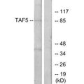 Western blot analysis of extracts from A549 cells, using TAF5 antibody.