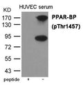 Western blot analysis of extracts from HUVEC cells treated with serum using PPAR-BP (Phospho-Thr1457) Antibody.The lane on the left is treated with the antigen-specific peptide.