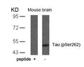 Western blot analysis of extracts from mouse brain tissue using Tau(Phospho-Ser262) Antibody and the same antibody preincubated with blocking peptide.