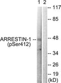 Western blot analysis of extracts from COS7 cells treated with Etoposide using Arrestin 1 (Phospho-Ser412) Antibody.The lane on the right is treated with the antigen-specific peptide.
