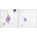 Immunohistochemistry analysis of paraffin-embedded human brain tissue using ALK antibody.