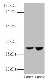 Western blot
All lanes: UQCRFS1 antibody at 2µg/ml
Lane 1: EC109 whole cell lysate
Lane 2: 293T whole cell lysate
Secondary
Goat polyclonal to rabbit IgG at 1/15000 dilution
Predicted band size: 30 kDa
Observed band size: 30 kDa