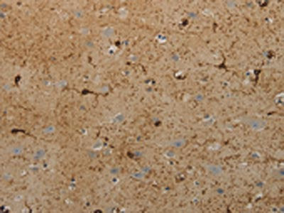 The image on the left is immunohistochemistry of paraffin-embedded Human brain tissue using CSB-PA046504(AATK Antibody) at dilution 1/25, on the right is treated with synthetic peptide. (Original magnification: ×200)