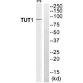 Western blot analysis of extracts from 3T3 cells, using TUT1 antiobdy.