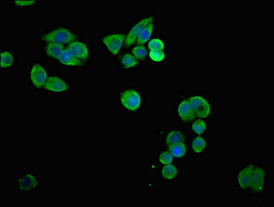 Immunofluorescent analysis of PC-3 cells using CSB-PA04679A0Rb at dilution of 1:100 and Alexa Fluor 488-congugated AffiniPure Goat Anti-Rabbit IgG(H+L)