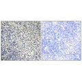 Immunohistochemistry analysis of paraffin-embedded human thymus gland tissue using TPIP1 antibody.