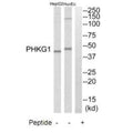 Western blot analysis of extracts from HuvEc cells and HepG2 cells, using PHKG1 antibody.