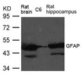 Western blot analysis of extract from Rat brain, Rat hippocampus tissue and C6  cells  using GFAP   Antibody