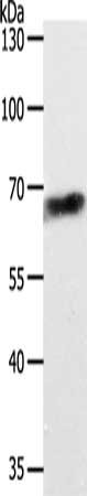 Gel: 10%SDS-PAGE, Lysate: 40 ug, Lane: Jurkat cells, Primary antibody: CSB-PA047241(ABCD4 Antibody) at dilution 1/700, Secondary antibody: Goat anti rabbit IgG at 1/8000 dilution, Exposure time: 1 minute
