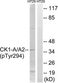 Western blot analysis of extracts from HT-29 cells treated with heat shock using CK-1α (Phospho-Tyr294) Antibody.The lane on the right is treated with the antigen-specific peptide.