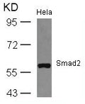 Western blot analysis of extracts from Hela cells using Smad2(Ab-467) Antibody.