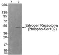 Western blot analysis of extracts from HuvEc cells (Lane 2), using Estrogen Receptor-α (Phospho-Ser102) Antibody. The lane on the left is treated with antigen-specific peptide.