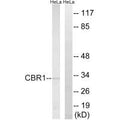 Western blot analysis of extracts from HeLa cells, using CBR1 antibody.