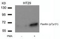 Western blot analysis of extracts from HT29 cells untreated or treated with PMA using Paxillin(Phospho-Tyr31) Antibody.