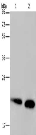 Gel: 10%SDS-PAGE, Lysate: 40 ug, Lane 1-2: Mouse heart tissue, Mouse kidney tissue, Primary antibody: CSB-PA048629(NDUFS4 Antibody) at dilution 1/200, Secondary antibody: Goat anti rabbit IgG at 1/8000 dilution, Exposure time: 20 seconds