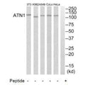 Western blot analysis of extracts from HeLa cells, A549 cells, K562 cells, COLO205 cells and NIH-3T3 cells, using ATN1 antibody.