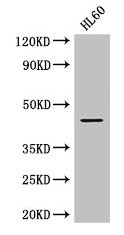 Western Blot
Positive WB detected in: HL60 whole cell lysate
All lanes: MAP2K2 antibody at 2.8µg/ml
Secondary
Goat polyclonal to rabbit IgG at 1/50000 dilution
Predicted band size: 45 kDa
Observed band size: 45 kDa