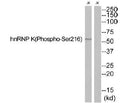 Western blot analysis of extracts from JurKat cells, using hnRNP K (Phospho-Ser216) antibody. The lane on the right is treated with the synthesized peptide.