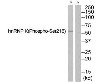 Western blot analysis of extracts from JurKat cells, using hnRNP K (Phospho-Ser216) antibody. The lane on the right is treated with the synthesized peptide.