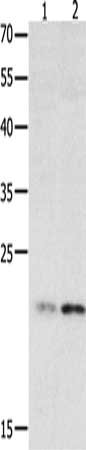 Gel: 12%SDS-PAGE, Lysate: 40 ug, Lane 1-2: 231 cells, human fetal liver tissue, Primary antibody: CSB-PA049190(HMGB4 Antibody) at dilution 1/500, Secondary antibody: Goat anti rabbit IgG at 1/8000 dilution, Exposure time: 2 minutes