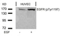 Western blot analysis of extracts from HUVEC cells untreated or treated with EGF using EGFR(Phospho-Tyr1197) Antibody.