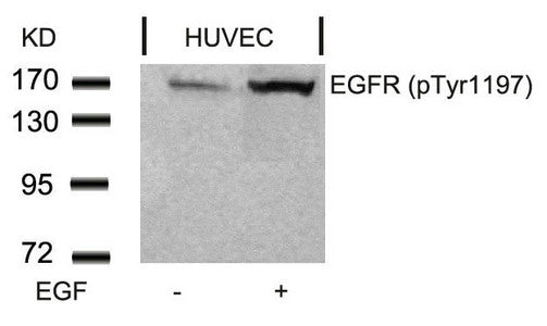 Western blot analysis of extracts from HUVEC cells untreated or treated with EGF using EGFR(Phospho-Tyr1197) Antibody.
