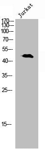 Western Blot analysis of Jurkat cells using Phospho-p47-phox (S345) Polyclonal Antibody
