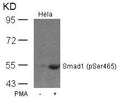 Western blot analysis of extracts from Hela cells untreated or treated with PMA using Smad1(Phospho-Ser465) Antibody.