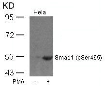 Western blot analysis of extracts from Hela cells untreated or treated with PMA using Smad1(Phospho-Ser465) Antibody.