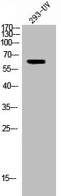 Western Blot analysis of 293 cells using Phospho-TH (S62) Polyclonal Antibody