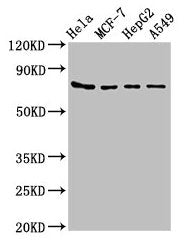 Western Blot
Positive WB detected in: Hela whole cell lysate, MCF-7 whole cell lysate, HepG2 whole cell lysate, A549 whole cell lysate
All lanes: HSPA5 antibody at 4µg/ml
Secondary
Goat polyclonal to rabbit IgG at 1/50000 dilution
Predicted band size: 73 kDa
Observed band size: 73 kDa