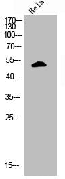 Western Blot analysis of HELA cells using Phospho-p53 (S366) Polyclonal Antibody