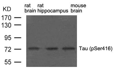 Western blot analysis of extract from rat brain, rat hippocampus and mouse brain using Tau(phospho-Ser416) Antibody.