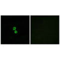 Immunofluorescence analysis of MCF-7 cells, using CKLF1 antibody.