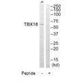 Western blot analysis of extracts from Jurkat cells, using TBX18 antibody.