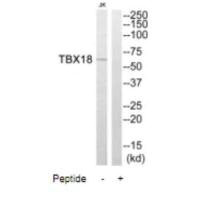 Western blot analysis of extracts from Jurkat cells, using TBX18 antibody.