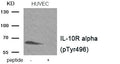 Western blot analysis of extracts HUVEC tissue using IL-10R alpha (Phospho-Tyr496) antibody.The lane on the right is treated with the antigen-specific peptide.