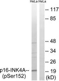 Western blot analysis of extracts from HeLa cells, treated with EPO (20U/ml, 15mins), using p16-INK4a (Phospho-Ser152) antibody. The lane on the right is treated with the synthesized peptide.