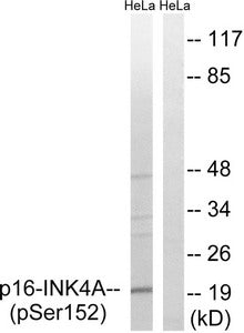 Western blot analysis of extracts from HeLa cells, treated with EPO (20U/ml, 15mins), using p16-INK4a (Phospho-Ser152) antibody. The lane on the right is treated with the synthesized peptide.